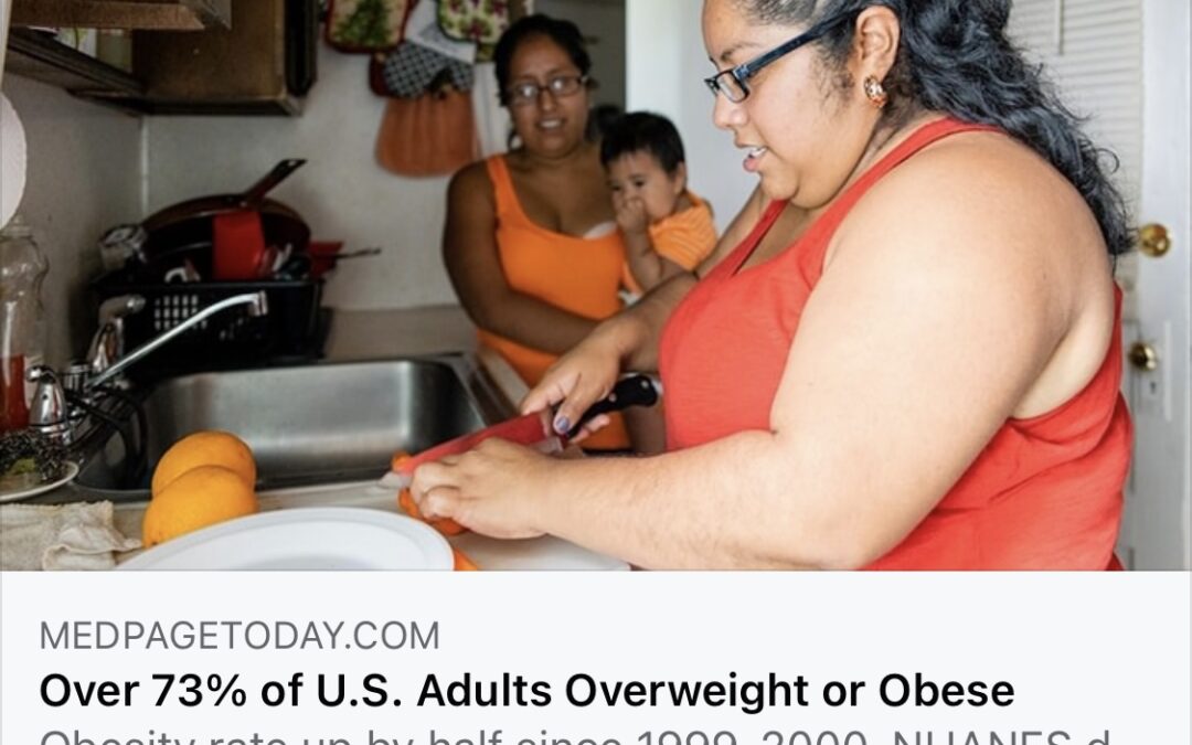 Almost 75% of US adults are now overweight or obese